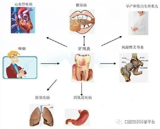 牙龈自发性出血的疾病有哪些,心脑血管疾病患者牙龈出血