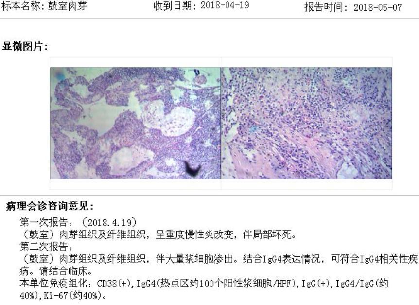 感冒哮喘用药不缓解,吃感冒药诱发哮喘