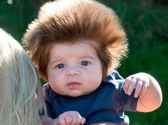 小孩头发像刺猬一样什么原因,小宝宝头发一绺一绺的是怎么回事