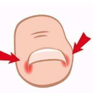 甲沟炎怎么办教你一招解决,甲沟炎怎么办用什么抗生素