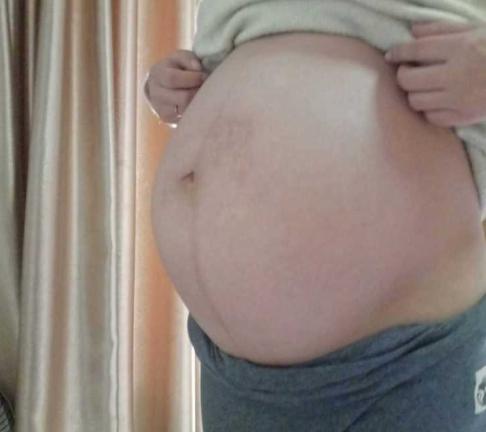 胎心胎芽都有了为什么还胎停,胎心出现又消失一定胎停了吗