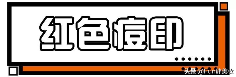 痘印痘坑真正祛除的方法,痘印痘坑去不掉怎么办
