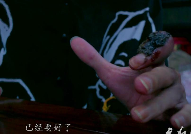 被毒杀的亲情纪录片,相杀相爱纪录片