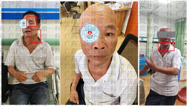 广药三院肿瘤一科,广药三院肿瘤综合治疗中心