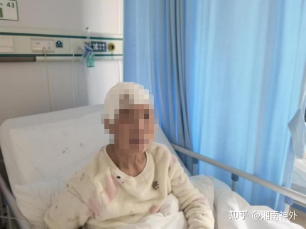 脑动脉瘤的定时炸弹,颅内定时炸弹