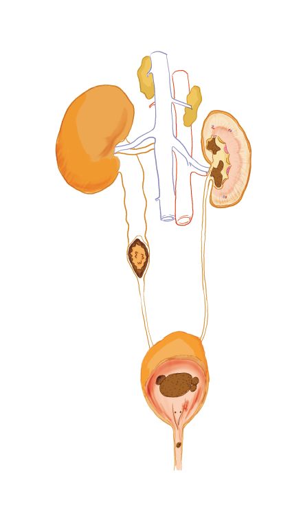 尿结石的危害视频,尿结石狗狗症状有哪些