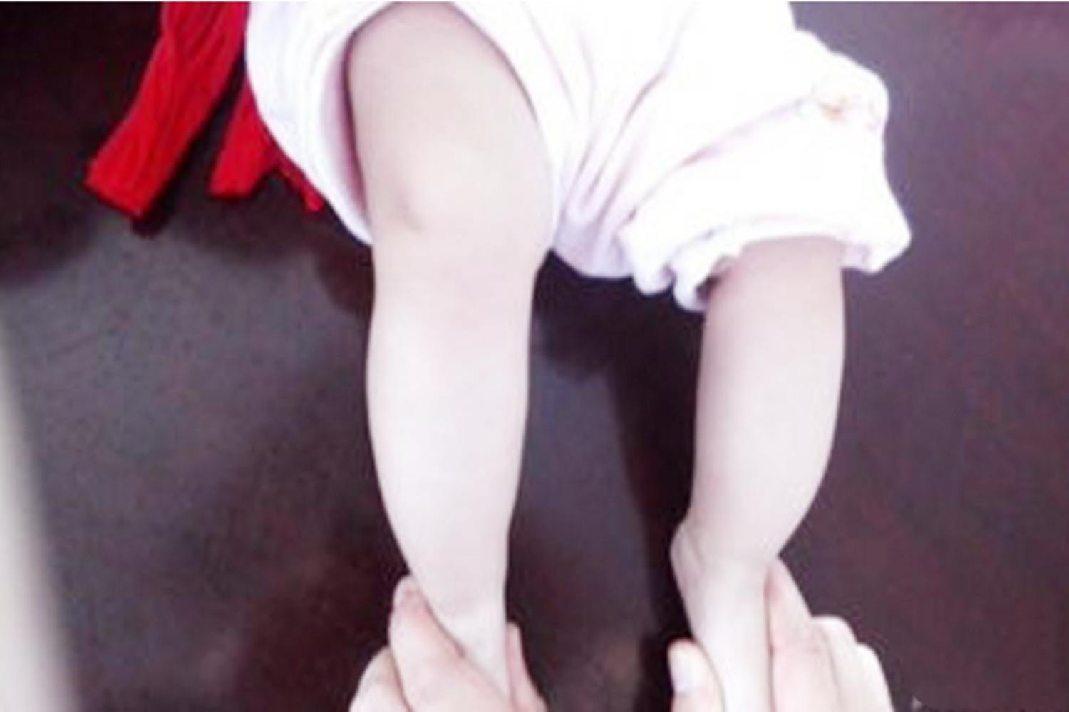 小孩弯曲腿到什么位置长高个,孩子腿部出现青筋