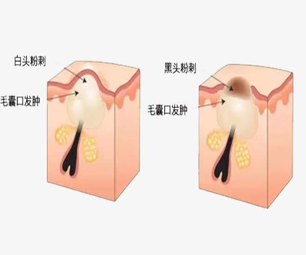 丽皙白护肤品怎么样,丽皙白精华