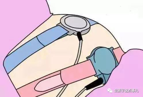 胎心监护每一次都要过关吗,胎心监护一定每次都过关吗