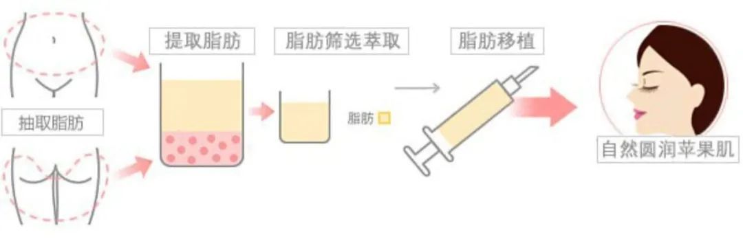 面部饱满是什么样的,面部窄才会面部饱满吗