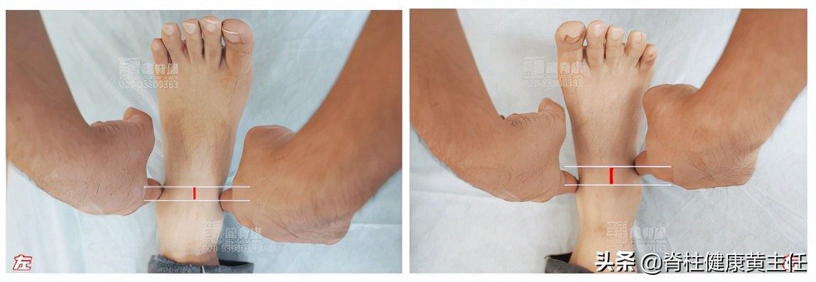 以前脚踝扭伤了现在经常会隐隐痛,脚踝扭伤后一直隐隐作痛怎么办