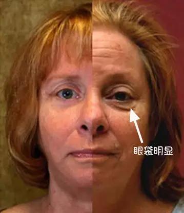 北大整形教授张宗学,张宗学博士微整形