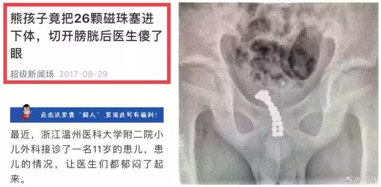 八岁女孩来大姨妈了疼痛难忍,八岁小女孩来姨妈