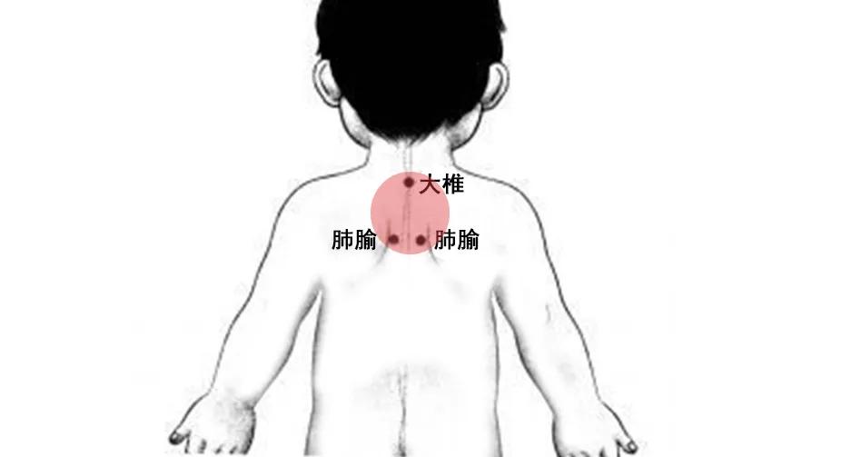 小儿推拿缓解鼻炎,缓解鼻炎需要推拿的穴位