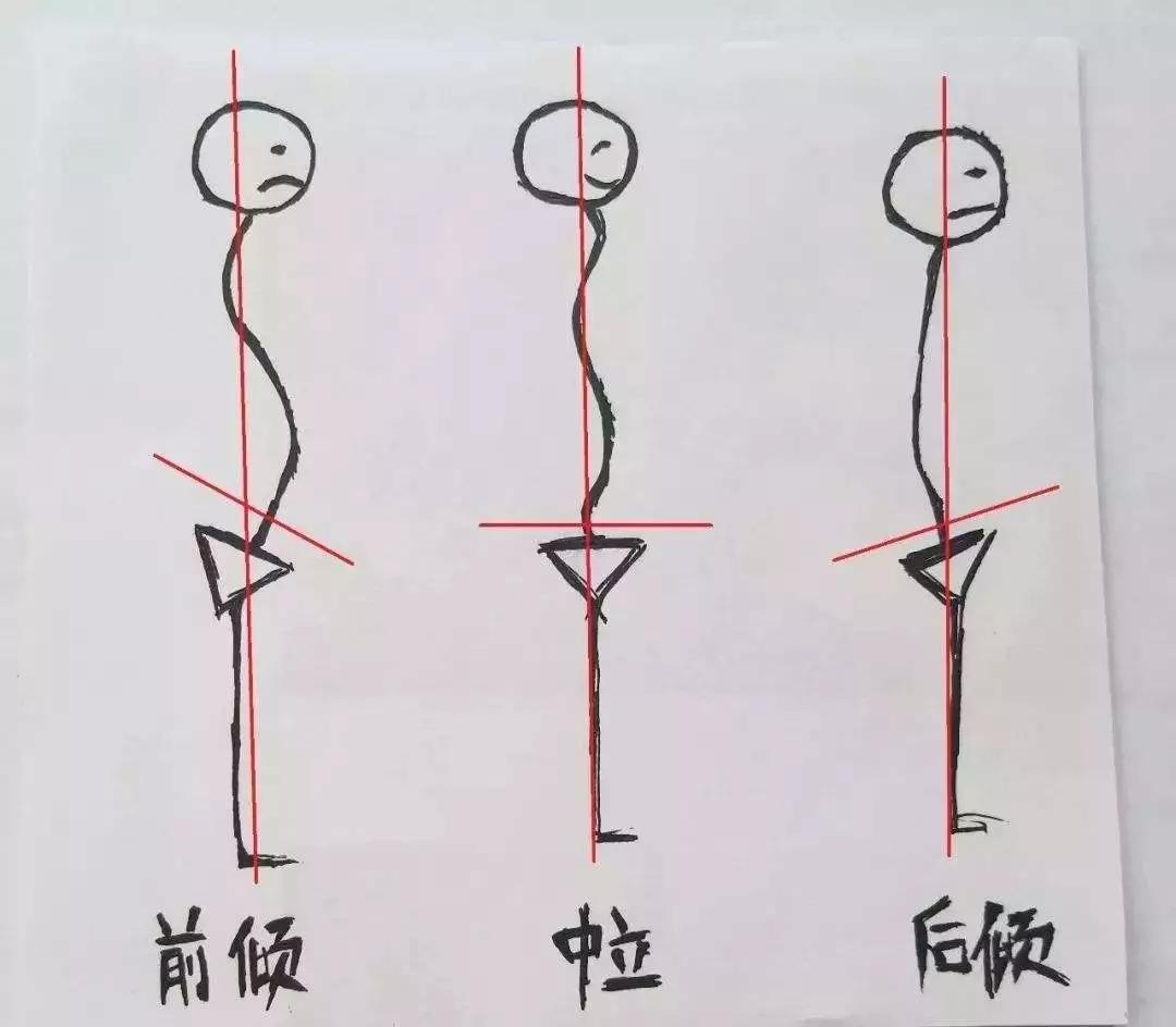 有些人看起来很正常其实有病,体型前凸后凸怎么改善