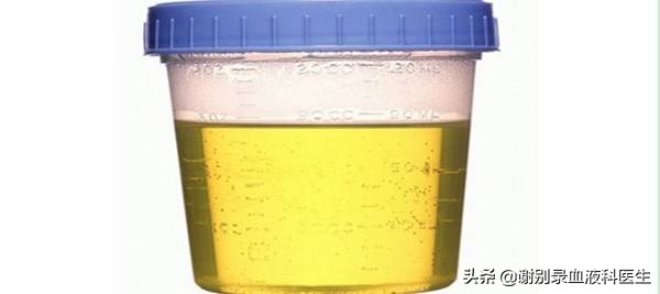 谢别录：如何通过分级护理降低过敏性紫癜患儿的凝血功能？