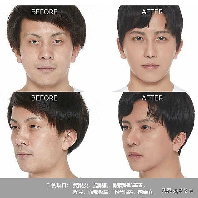 一个很丑的男生怎么改变自己,一个丑男人怎么变帅