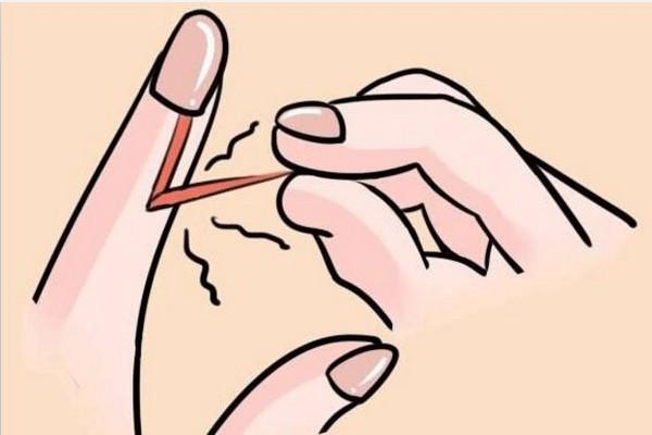 忍不住撕手皮,忍不住想撕手皮怎么回事