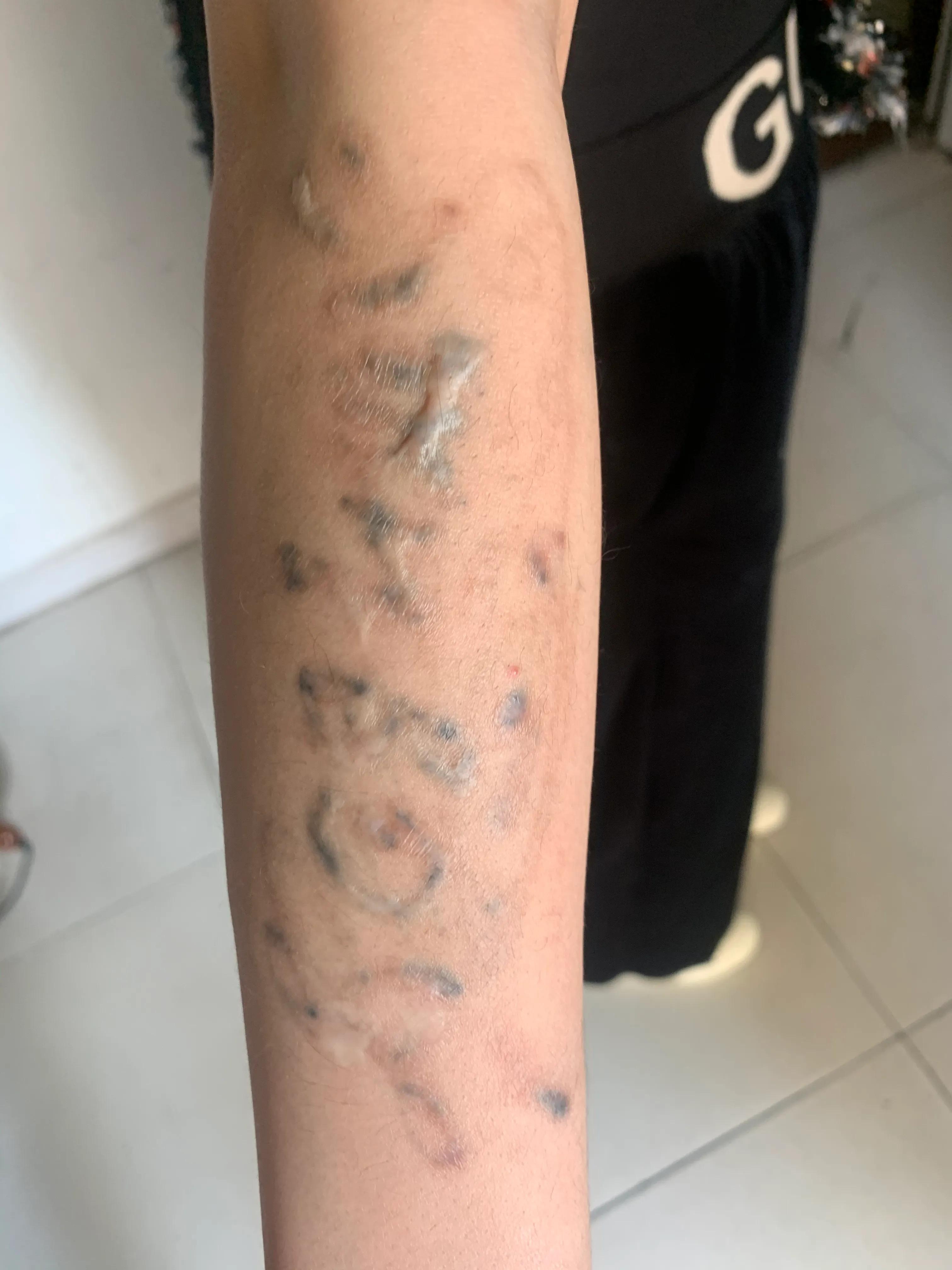 洗纹身到底能不能洗干净,洗纹身能不能彻底洗干净