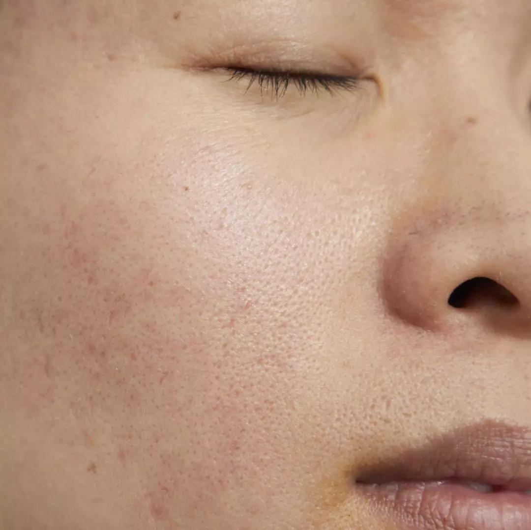 真人改造|不靠医美，一天实现“换皮”