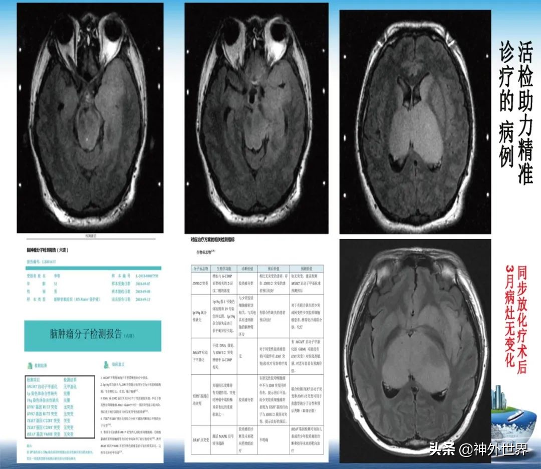 宣武医院神经外科王亚明祖籍,北京宣武医院神经科专家王亚明