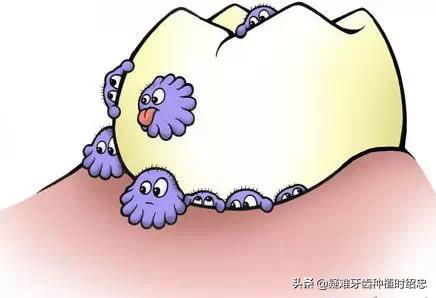 改变刷牙方式楔状缺损就会停止吗,刷牙导致楔状缺损牙齿会断么