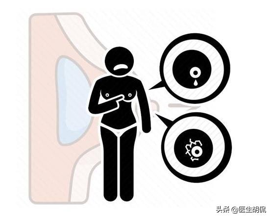 女性雌激素旺盛有4个表现,女性雌激素旺盛的6个表现