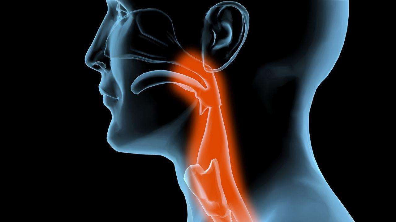 中医的梅核气属于咽炎典型症状吗,中医分析梅核气的病机