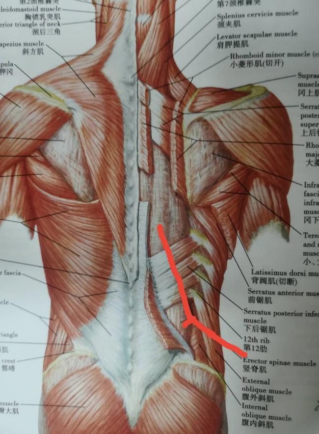 急性腰扭伤的正确睡姿,急性腰扭伤按哪个穴位图解