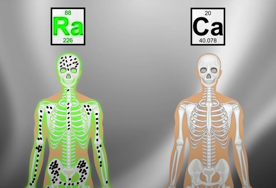牙齿烂光，脸长巨瘤，骨头还会发光，被美国资本家逼向绝路的女工