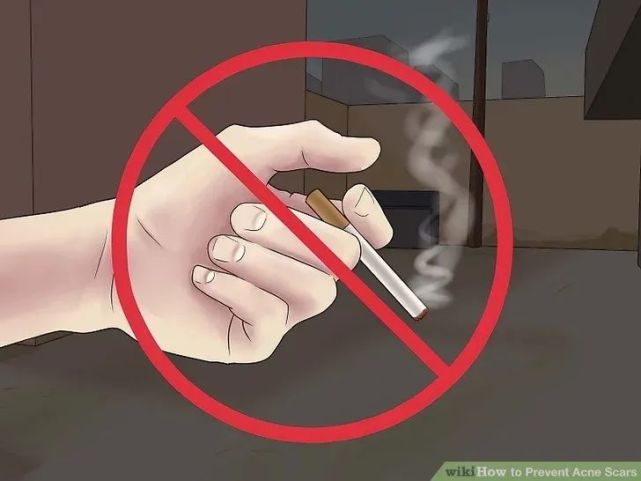 长完痘的红色痘坑怎么弄,怎么预防痘坑形成