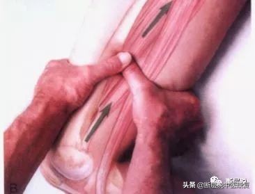 女性盆底健康问题，针刺要扎三阴交，手法要选内收肌