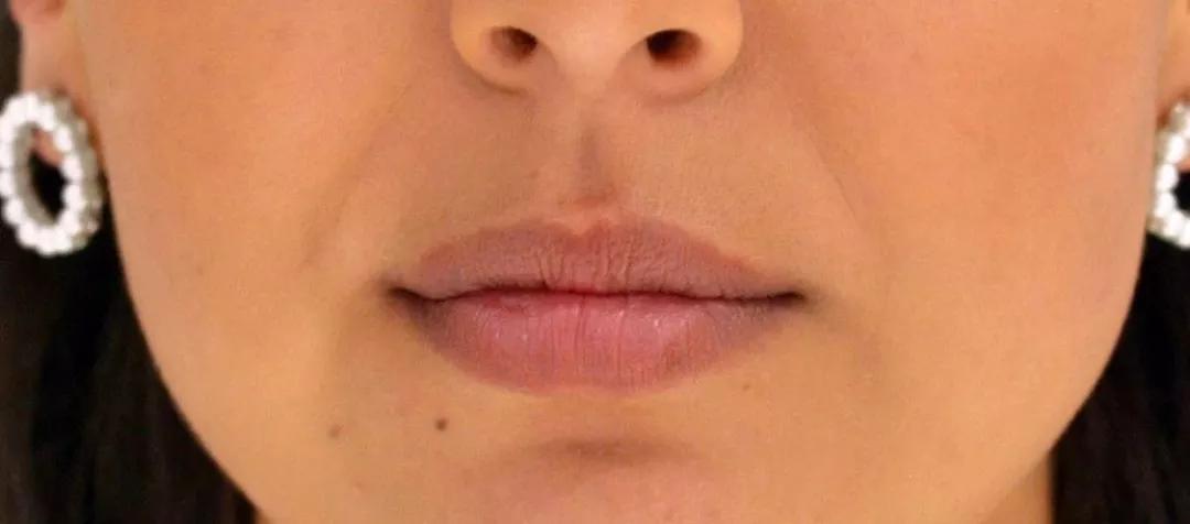 如何拥有元气骑士皮肤,怎么拥有少女感脸蛋