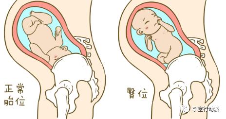 孕期指南第6周,孕期记录第38天