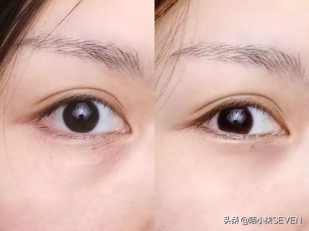 杨幂眼部,杨幂眼睛变大的秘诀