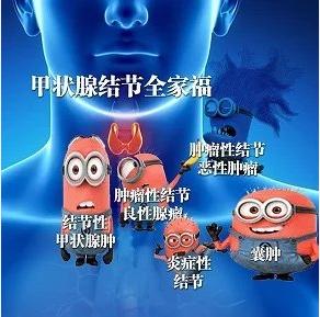 甲状腺良性滤泡性结节会癌变吗,甲状腺良性滤泡结节癌变率有多高