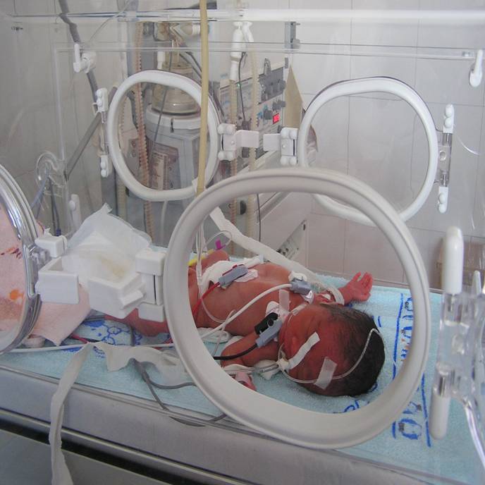 致死性B族链球菌感染,准妈妈不能忽视的产前筛查,你关注过吗?