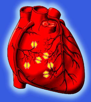 单硝酸异山梨酯、地尔硫卓、尼可地尔，3种抗心绞痛药有什么区别