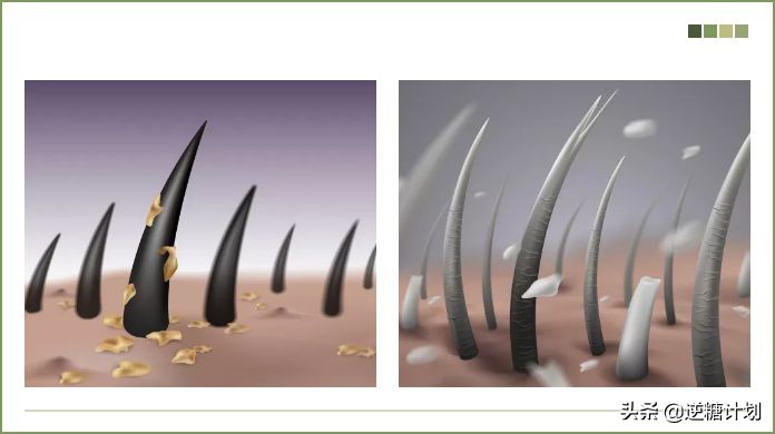 头皮发痒头皮屑多有小疙瘩怎么办,头皮严重发痒头皮屑多小妙招