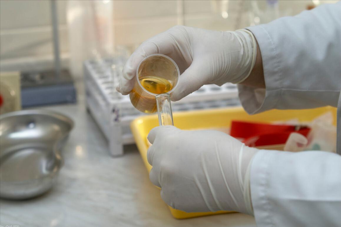 看尿判断尿蛋白,判定肾病测尿肌酐还是血肌酐