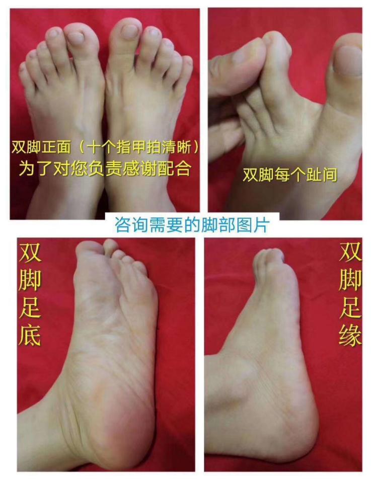 及时治疗脚气，是对家人最好的负责