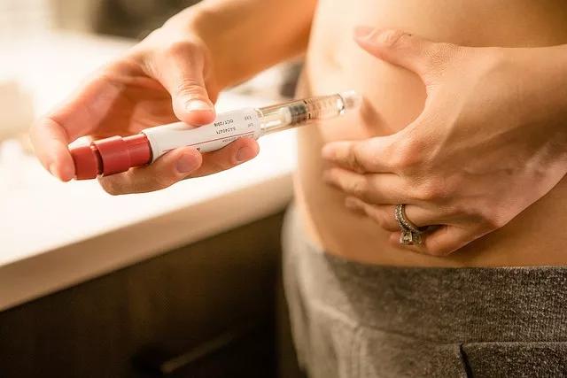 人工授精需要什么步骤,人工促排和人工授精