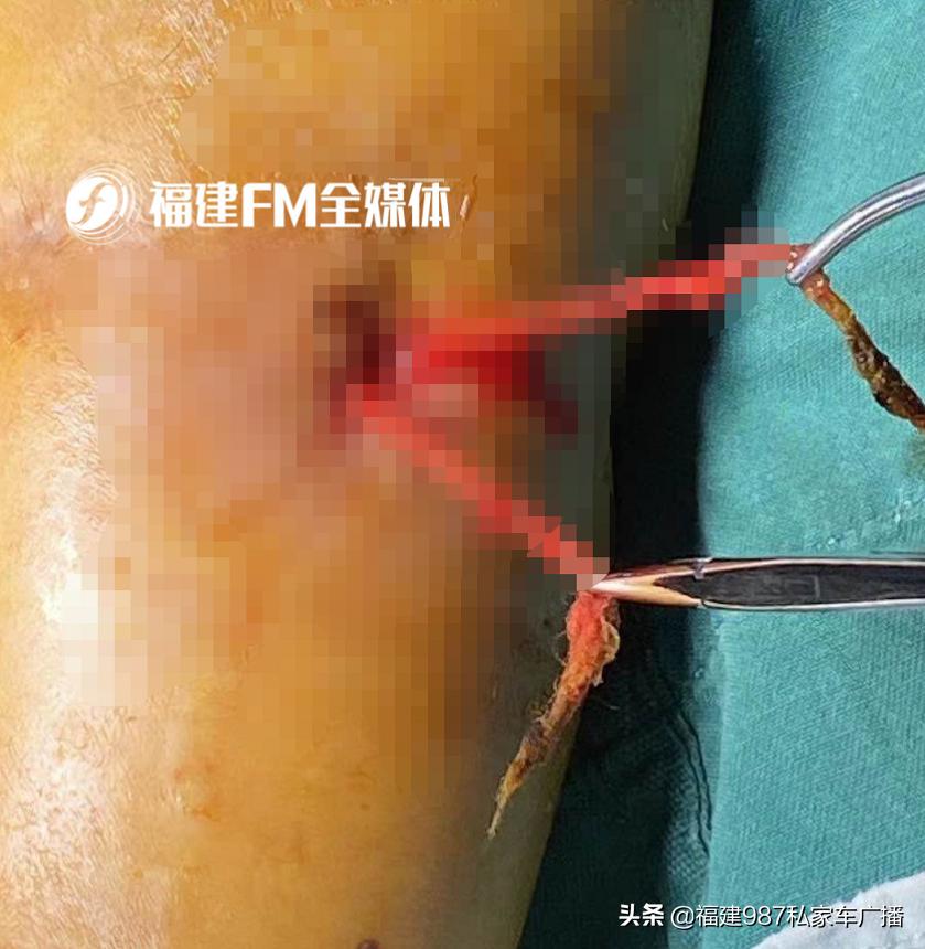 福建省级机关医院二甲,福建省级机关医院有哪些