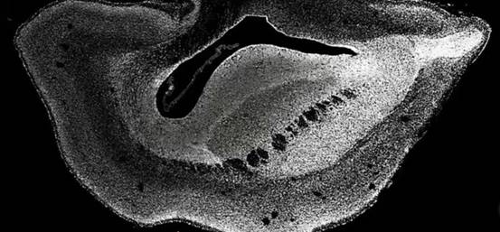 猴子会进化成凯撒吗,猴子会演化成人类吗