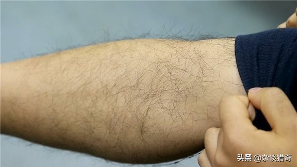 双性人的不幸,双性人的缺陷