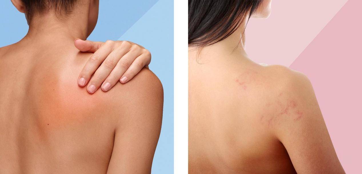 推荐6款特别好用的护肤品,修复皮肤屏障保湿的护肤品平价