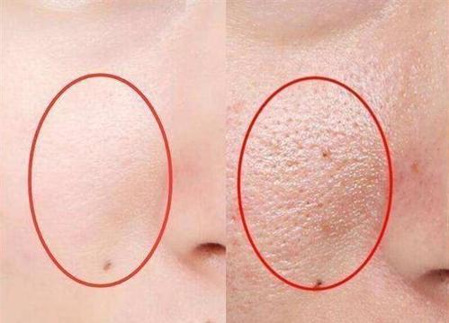 卸妆怎么才能卸干净呢,卸妆没卸干净怎么补救