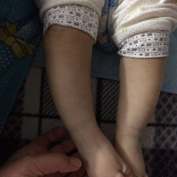 不想让宝宝一直穿纸尿裤怎么办,怎么不让刚会走路的宝宝罗圈腿