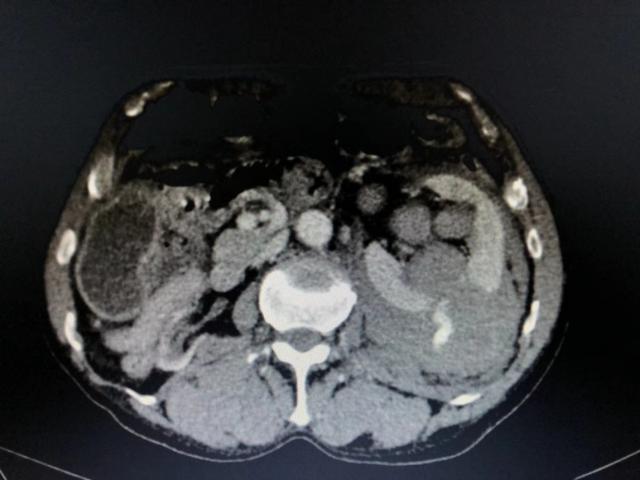 鲁渝扶贫协作简介,鲁渝扶贫协作十年成效卓著
