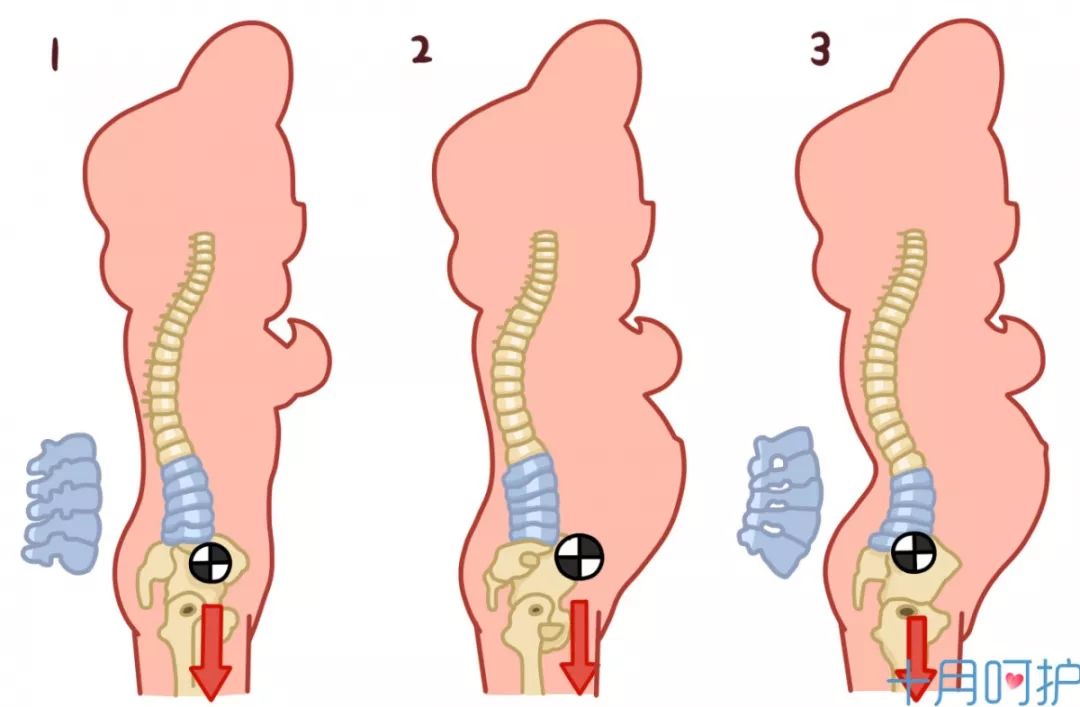产后腰酸背痛是怎么回事呢,产后腰痛是因为月子没坐好吗